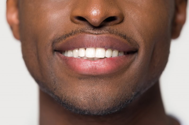 Why Dental Veneers in Colombia Are a Smart Choice for Americans